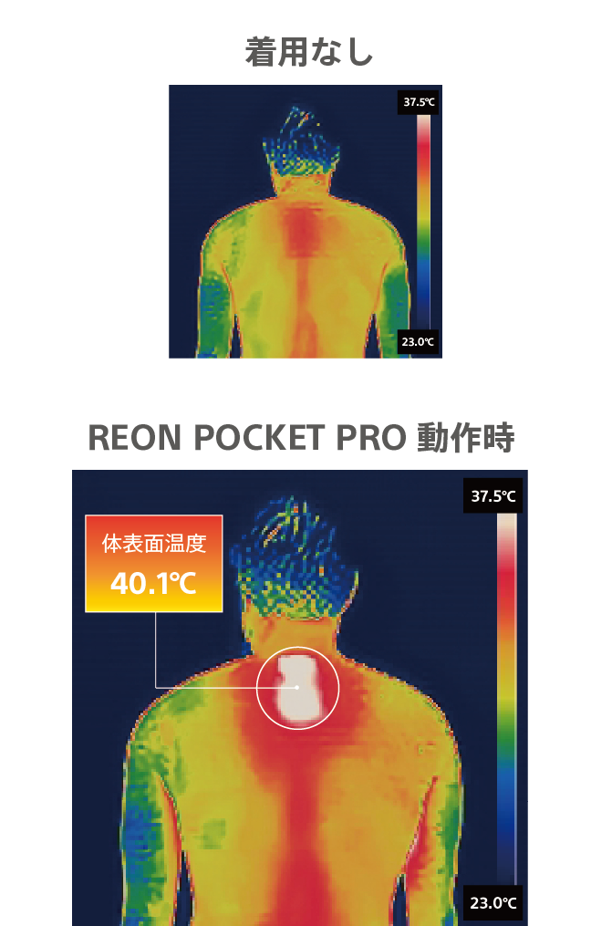 REON POCKET PROを装着して冬にWARMモードを使用した例、使用後の体表面温度40.1℃